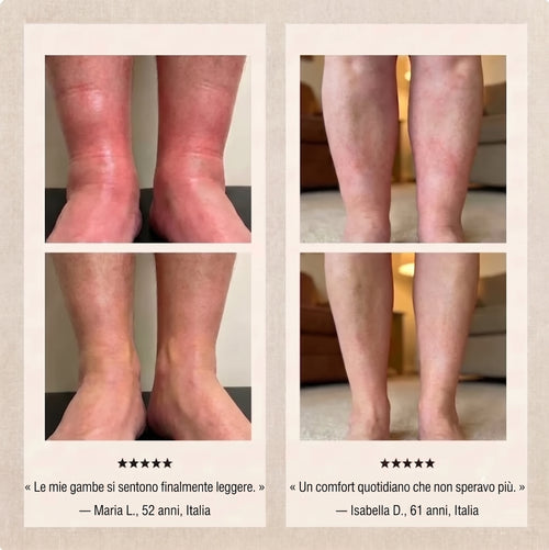 Gocce Drenanti | Formula Anticellulite e Gambe Leggere